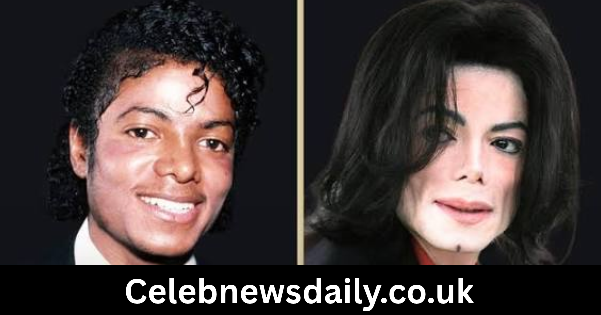 michael jackson plastic surgery timeline